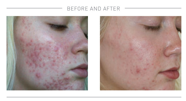 Advanced Nutrition Programme Skin Accumax Starter Pack