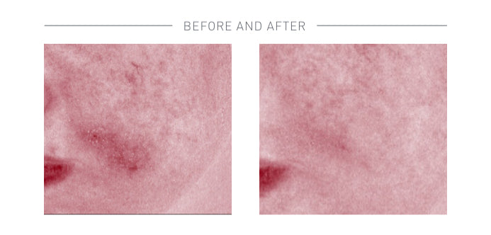 Advanced Nutrition Programme Skin Omegas+